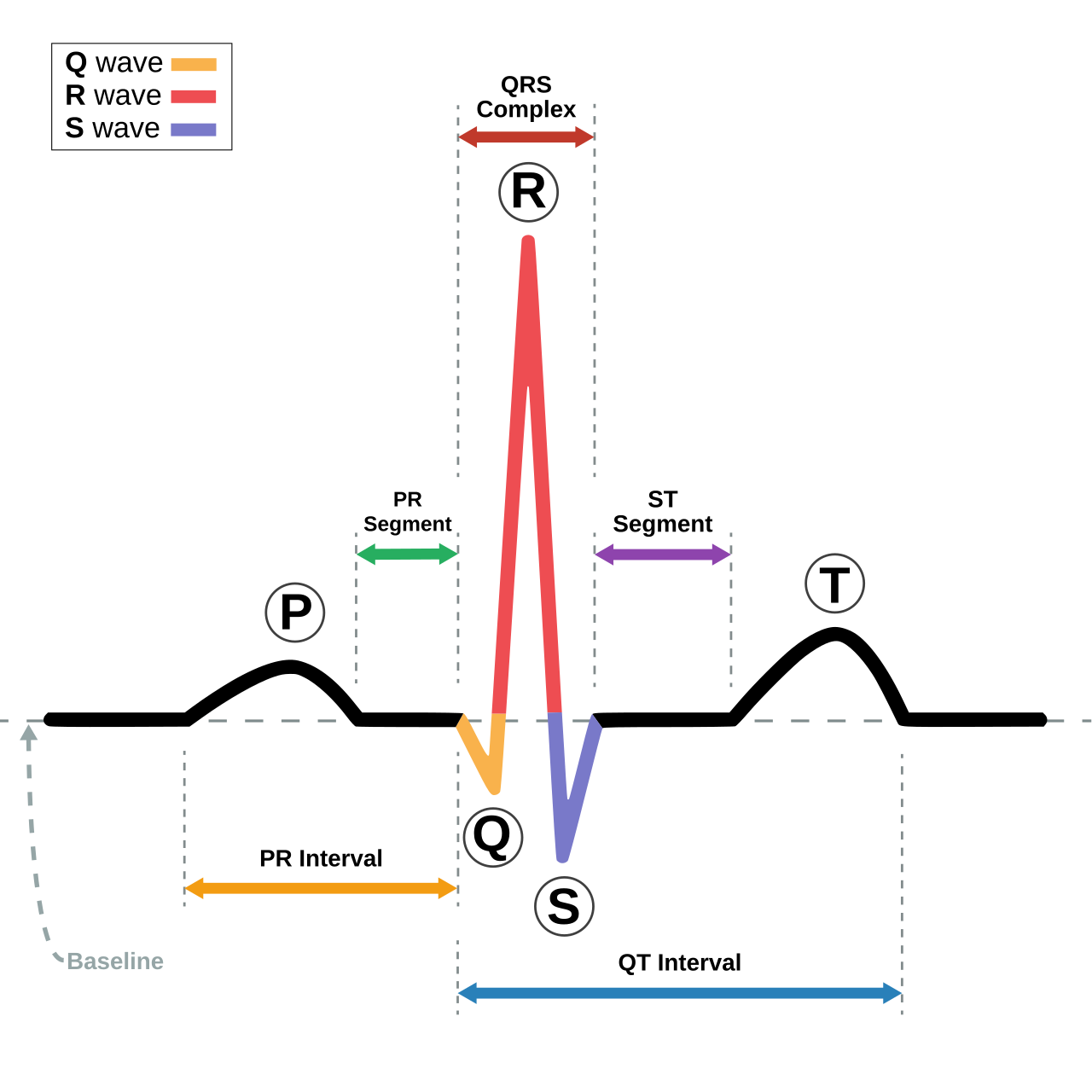 Diagram of heart's electrical beat (ECG).